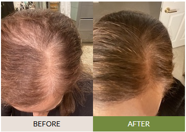 FullyVital user testimonial highlighting restored hair volume and non-greasy feel after serum use
