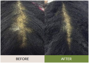 Before and after image showing improved hair density in post-menopausal user using FullyVital