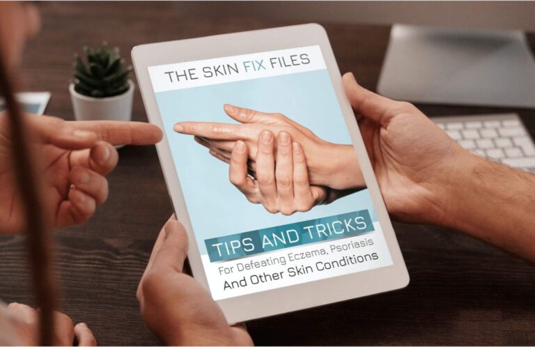 Bonus eBook titled "The Skin Fix Files" offering tips for managing eczema, psoriasis, and common skin conditions.