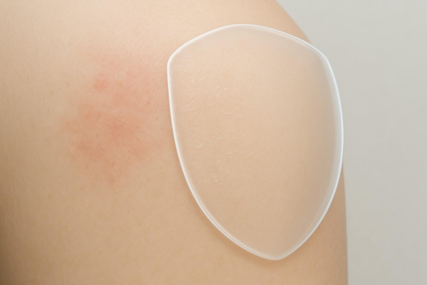 Ultra-realistic illustration showing mild skin irritation, dryness, and protective precautions for alpha arbutin use.
